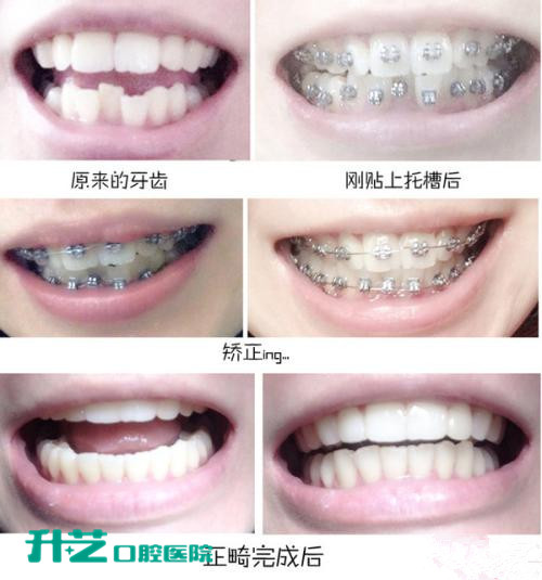 小榄口腔