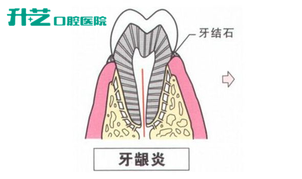 中山口腔医院