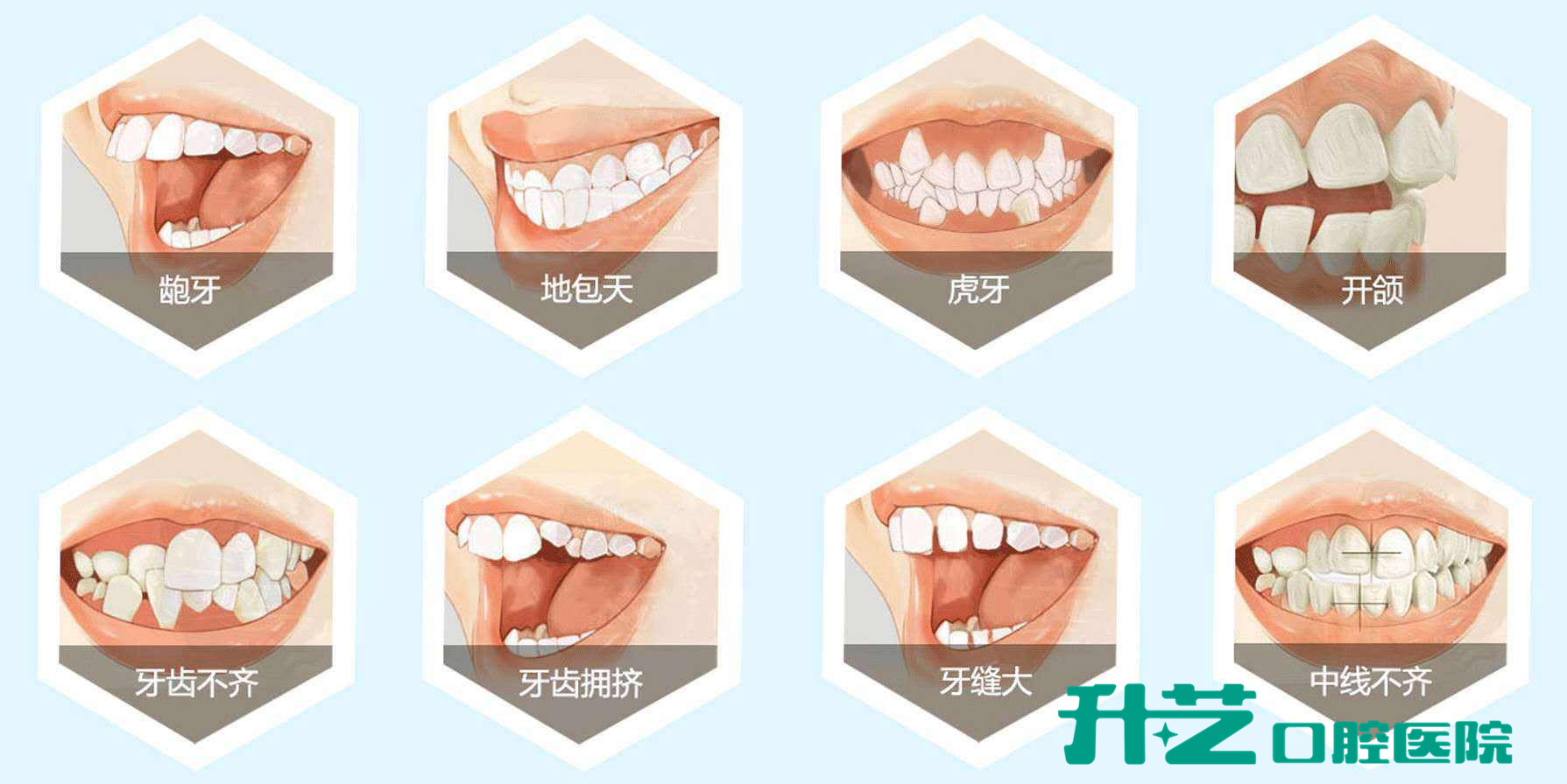 牙齿矫正