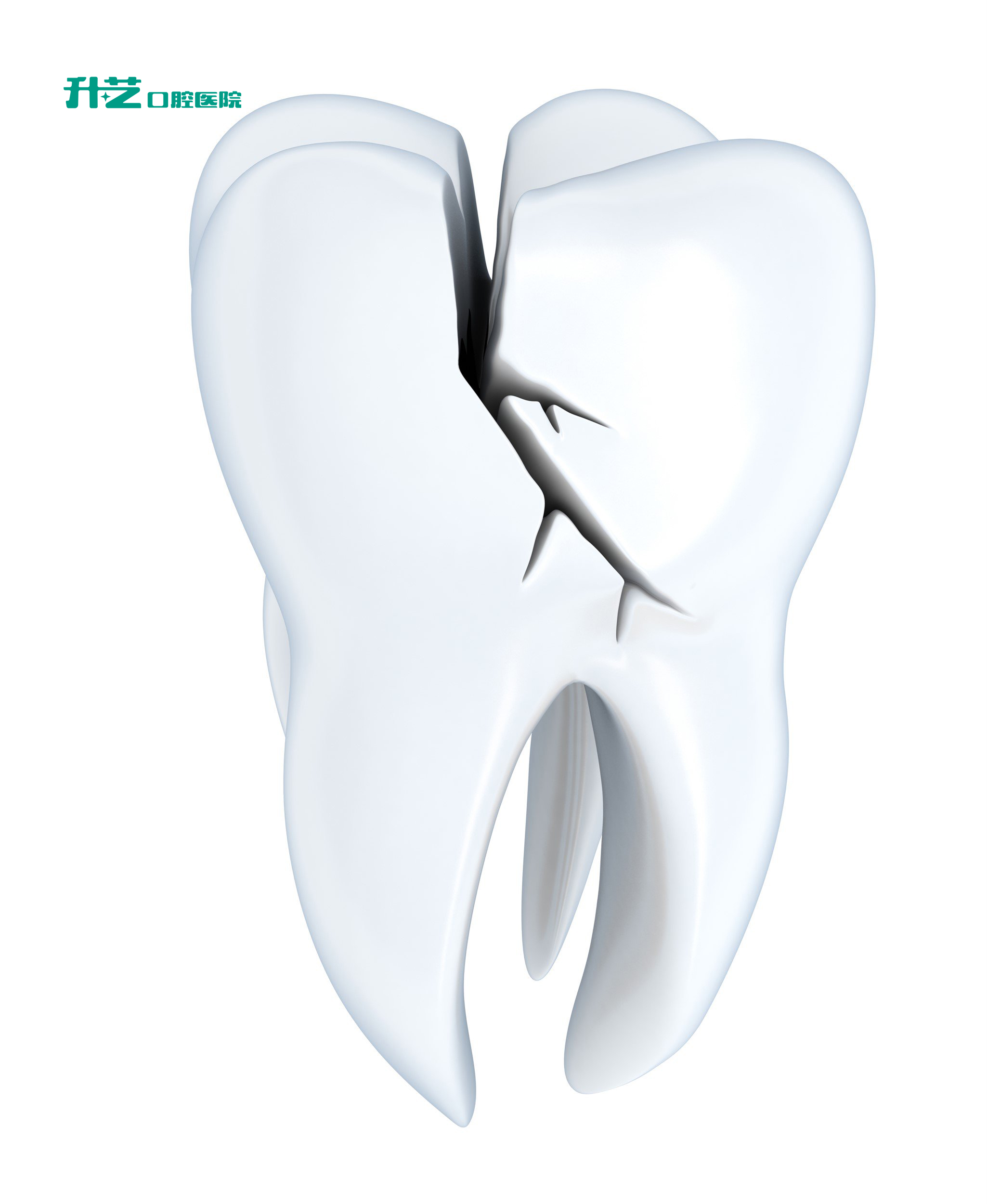 牙外伤的固定技术和牙髓治疗_侵权