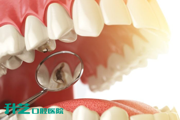 升艺口腔医院：牙外伤