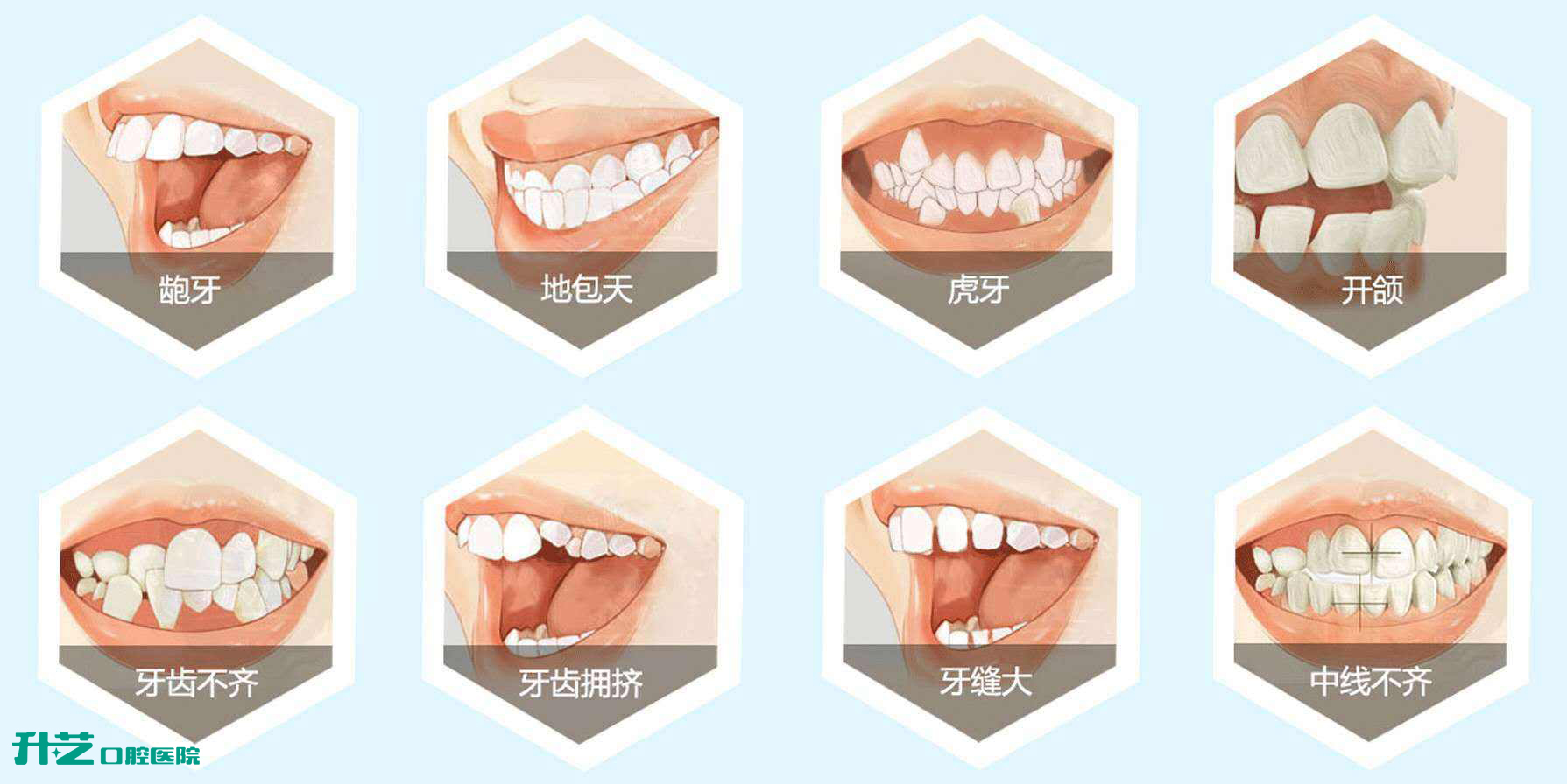 升艺口腔医院——牙齿正畸