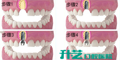 升艺口腔