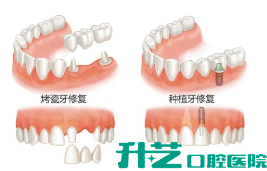 升艺口腔