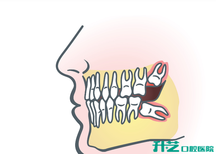 升艺口腔医院