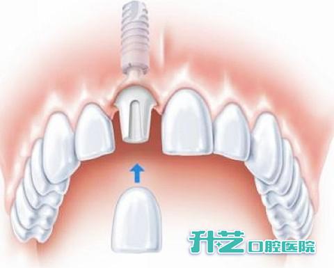 升艺口腔医院