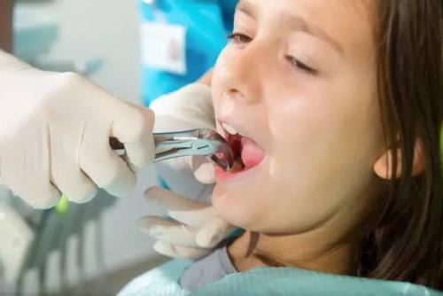 你是否还在纠结儿童是否能拔牙呢——升艺口腔医院告诉你！