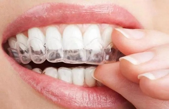 升艺口腔医青少年做牙齿正畸手术，一般有哪几种方式？院