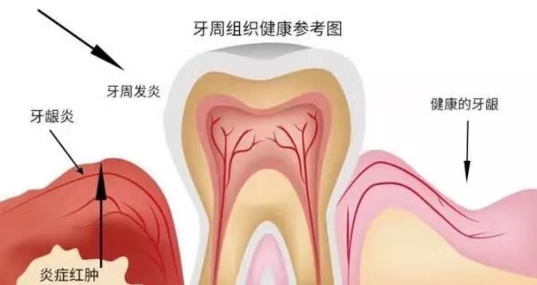 牙周基础知识