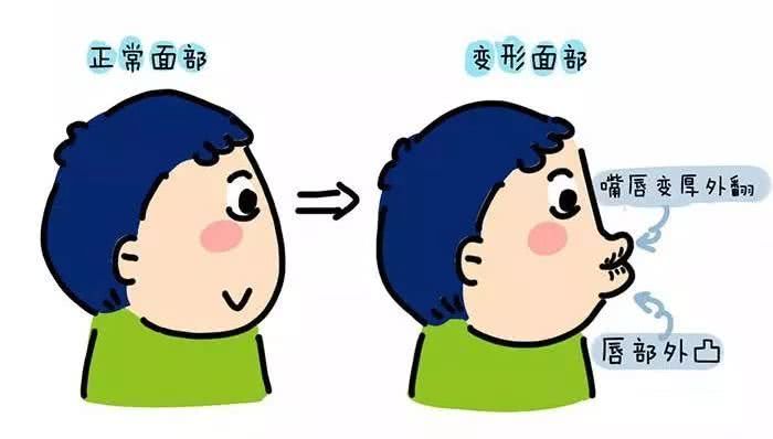 牙齿矫正