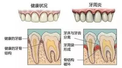 牙齿修复