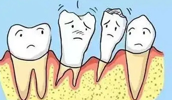 可怕的牙周炎到底是如何形成的，中山牙科教你怎么预防