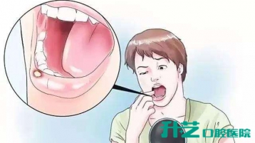 在中山洗牙后，如何进行正确的牙齿护理？