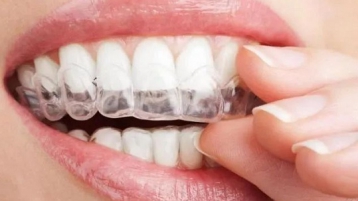 牙齿矫正的这些常见问题，你都清楚吗？