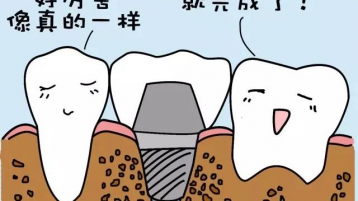 还认为种牙拍片很麻烦？那你就错了！