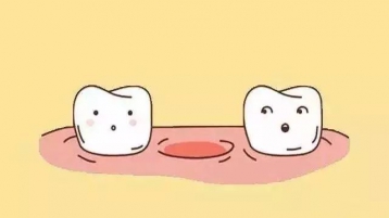 缺牙不只是“难以启齿”，听听中山口腔医院怎么说